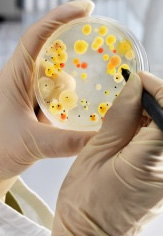 bacteria petri dish